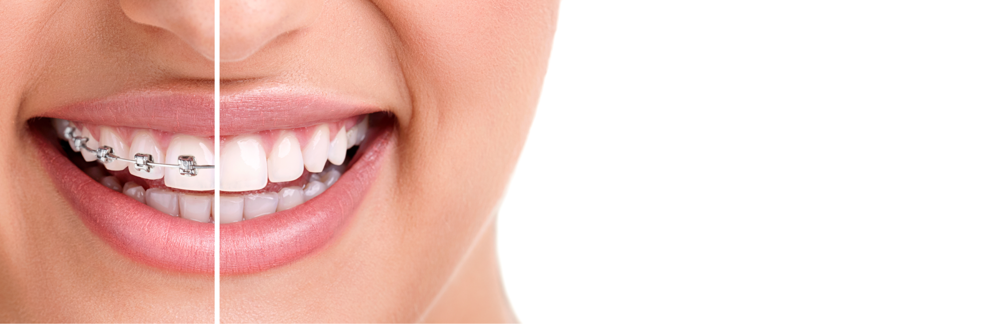 Mutualia-AC-orthodontie.png Mutualia-AC-orthodontie.png
